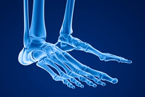 Fractures of the Fifth Metatarsal