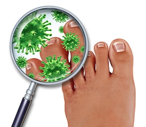 Preventing Toenail Fungus