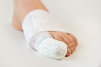 What Are the Symptoms of a Broken Toe?