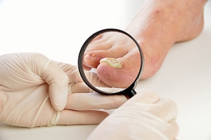 What to Do About Your Toenail Infection