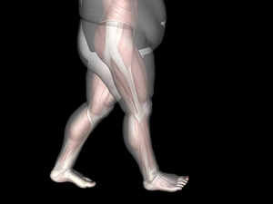 Obesity and Foot Pain