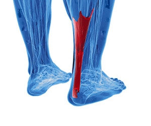 Symptoms and Causes of Achilles Tendonitis