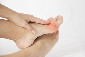 Dealing With Bunions